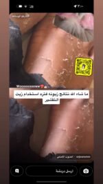 ⁦زيت تقشير الجسم⁩ - الصورة ⁦3⁩